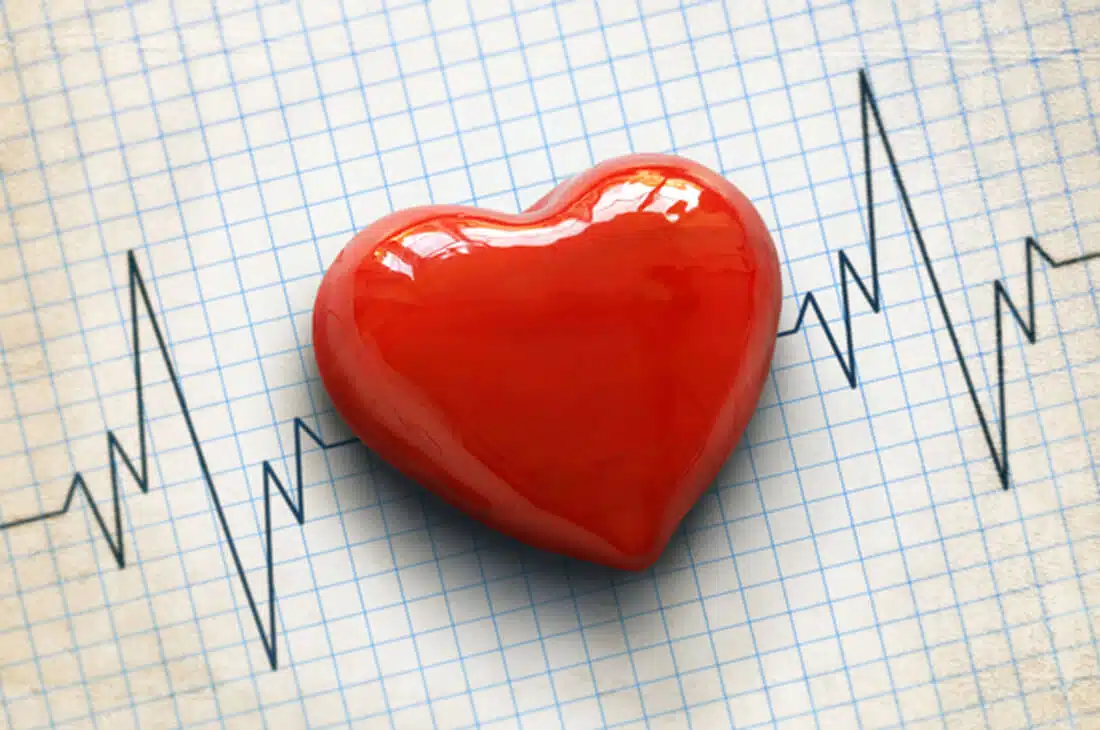 My Pounding Heart: Is it Anxiety or Atrial Fibrillation? | Research ...